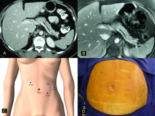 fig1